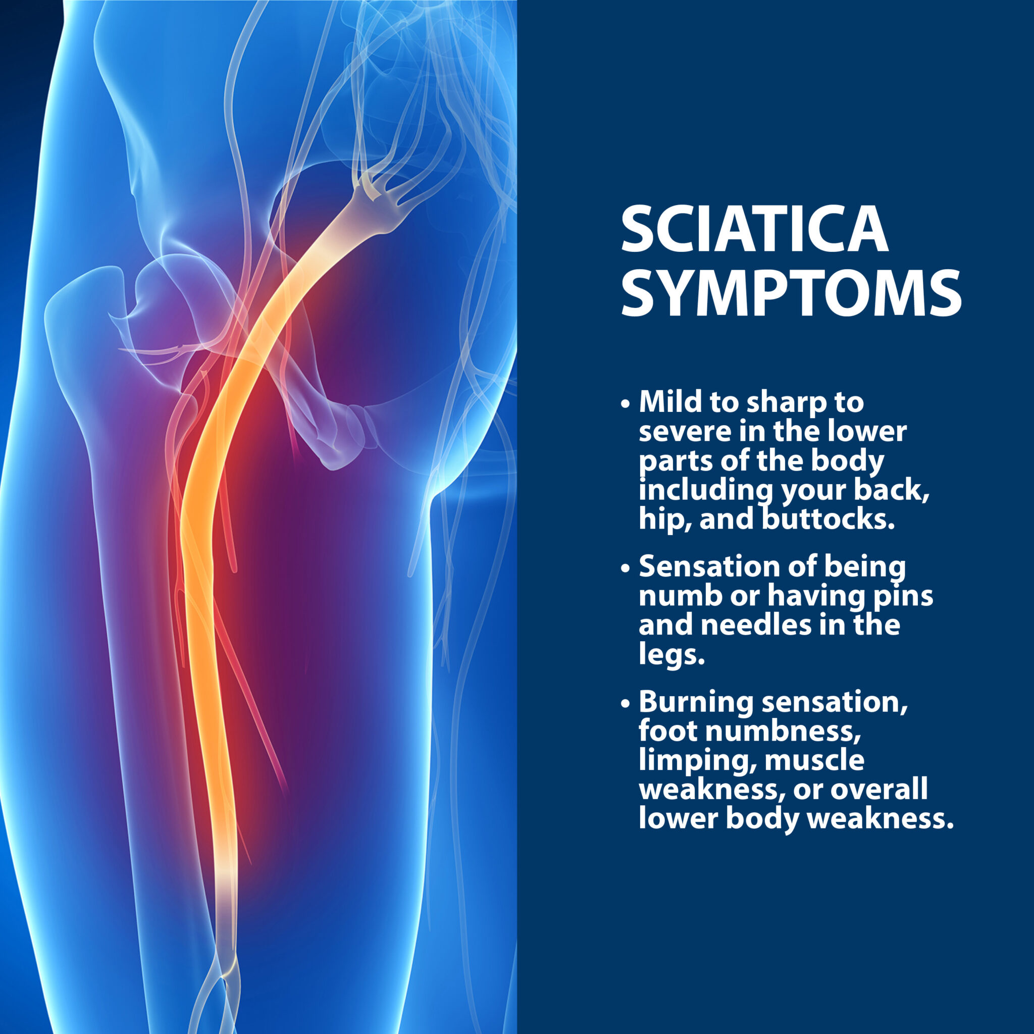 Can Sciatica Cause Discomfort In Genital Area