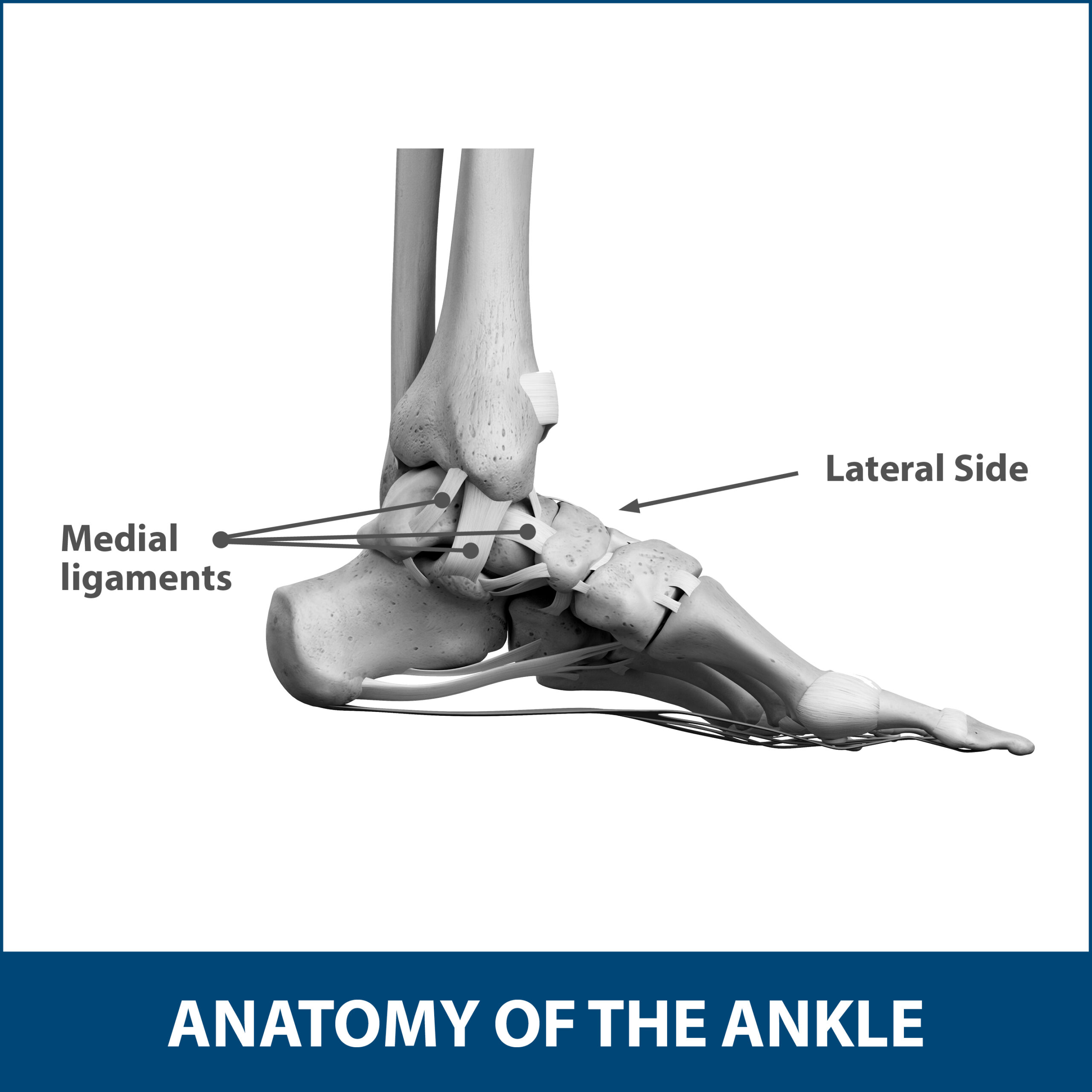 Ankle Fracture Surgery Video, Ankle Sprain