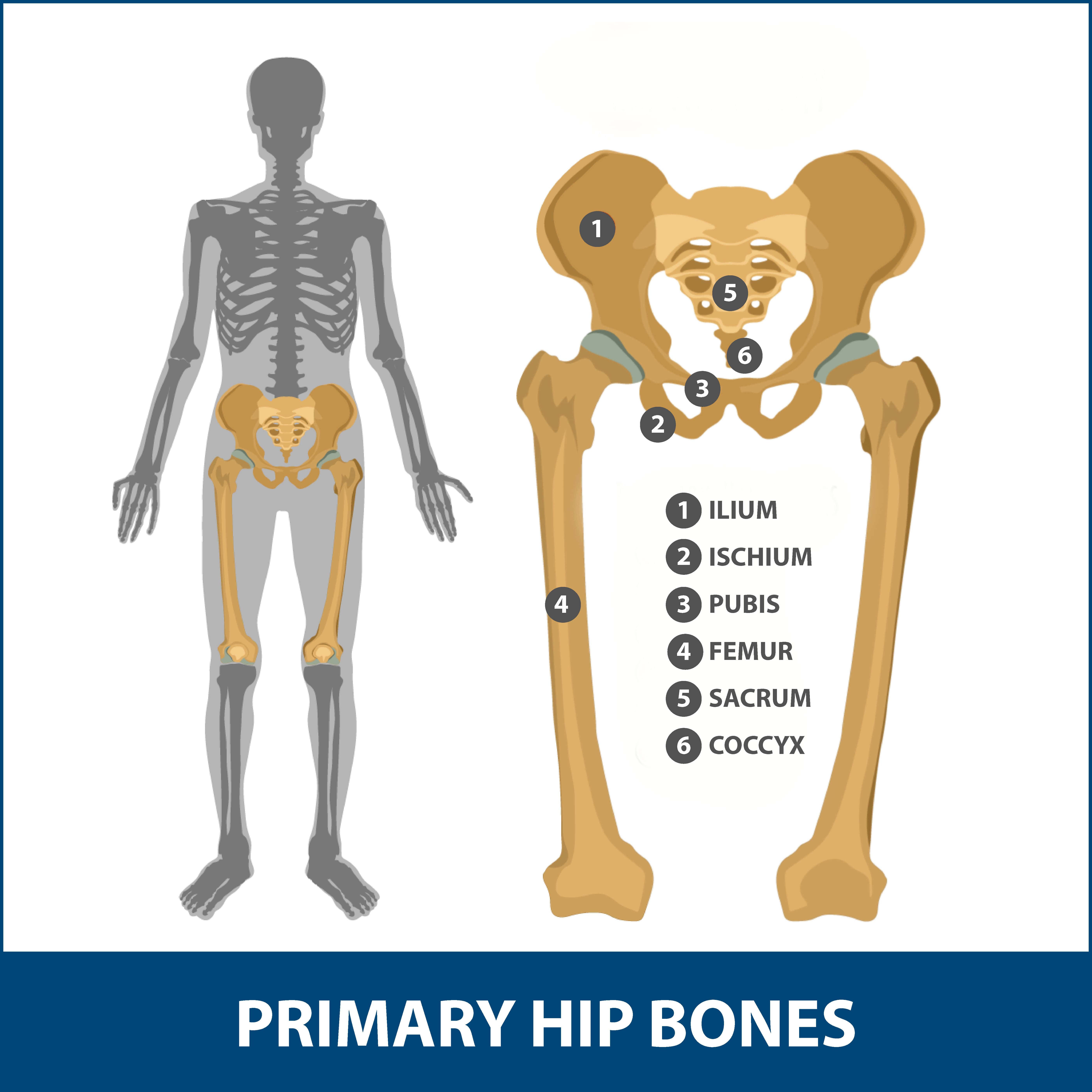 Hip Dislocation Information  Florida Orthopaedic Institute
