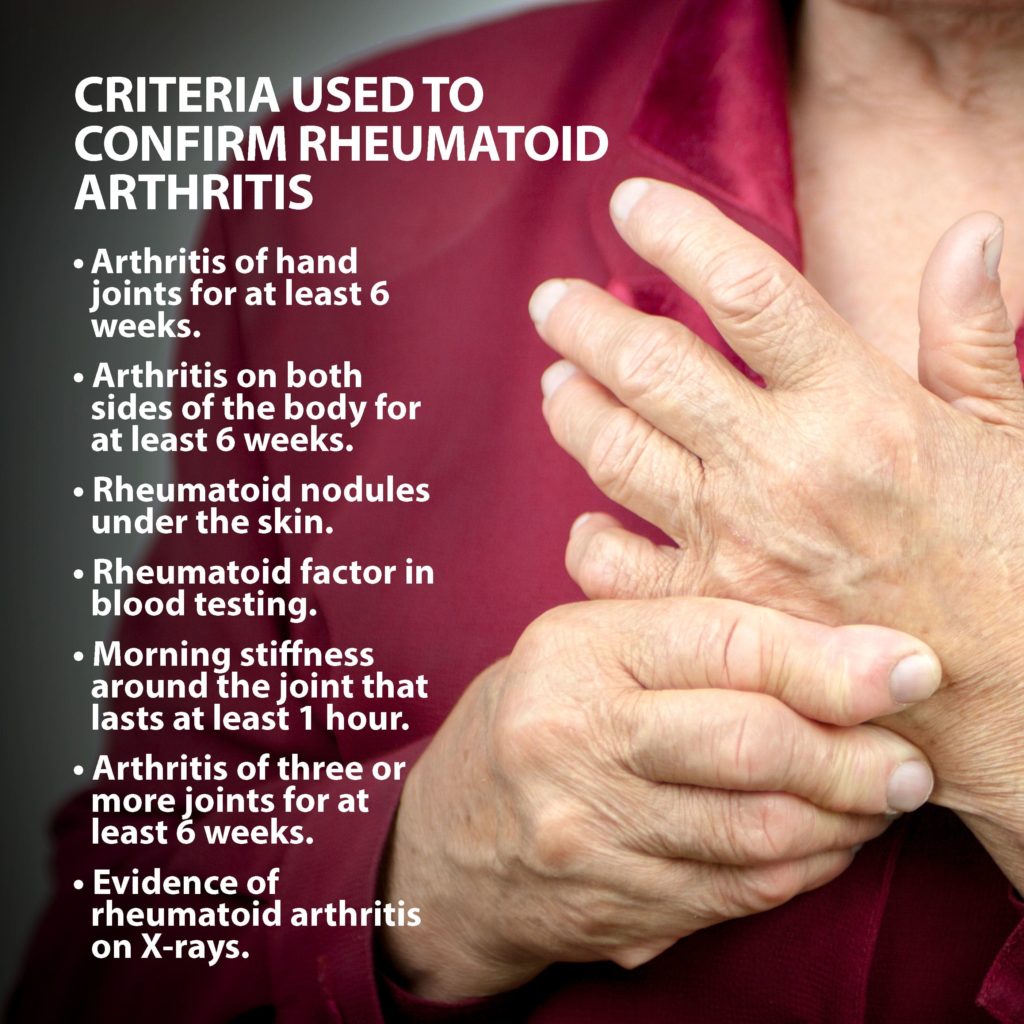 types of arthritis in hands        <h3 class=