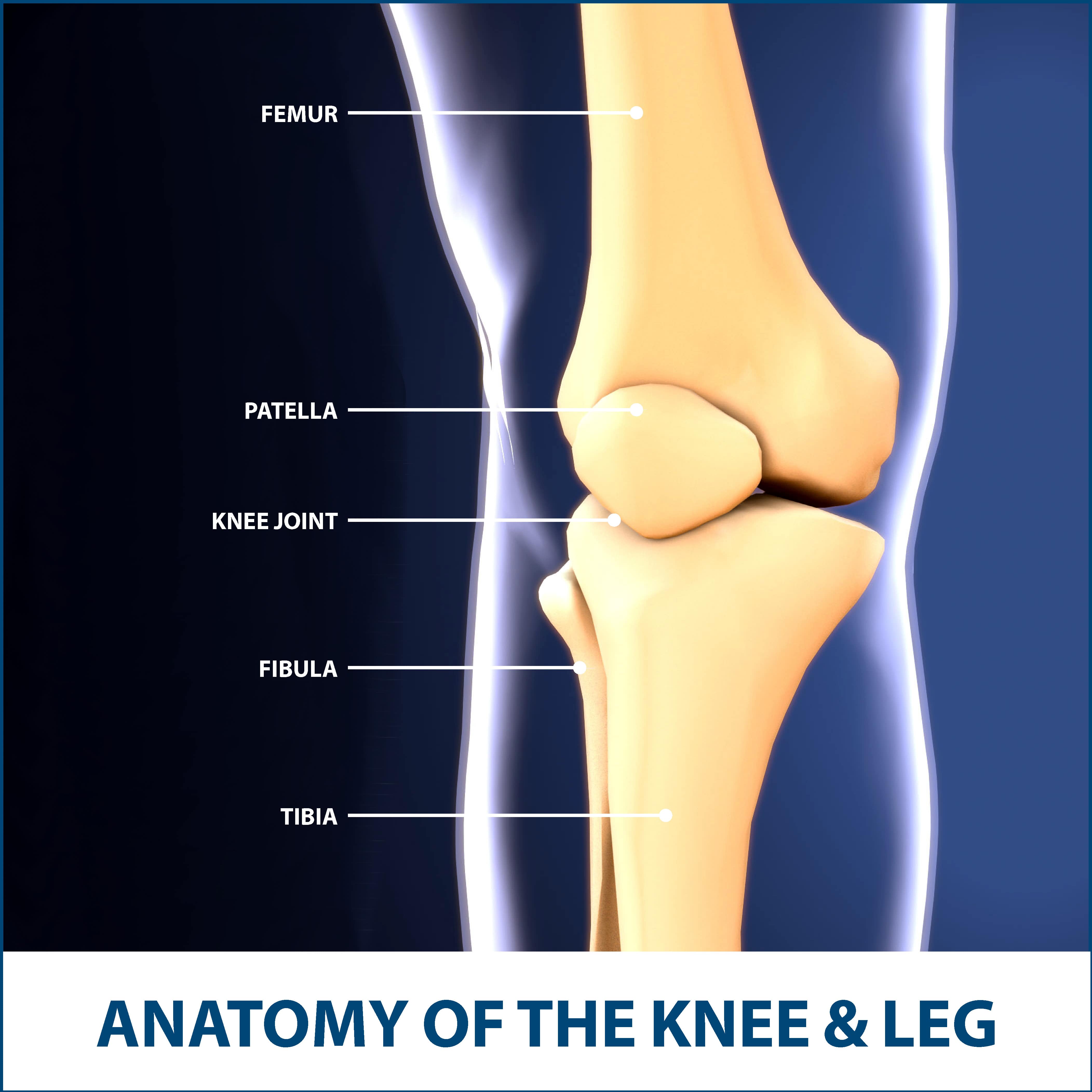 knee fracture