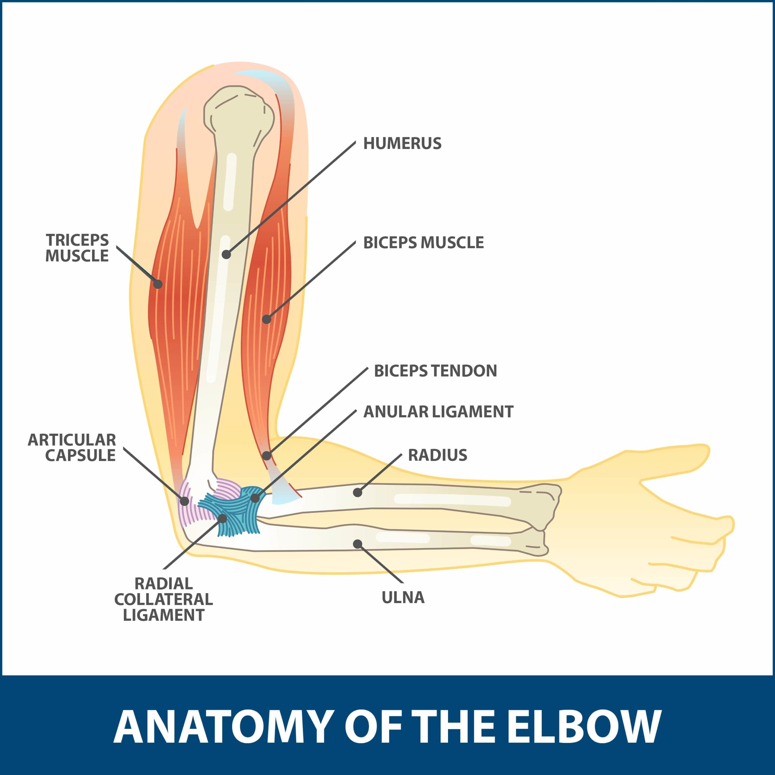 Hyperextension Injury of the Elbow | Florida Orthopaedic Institute