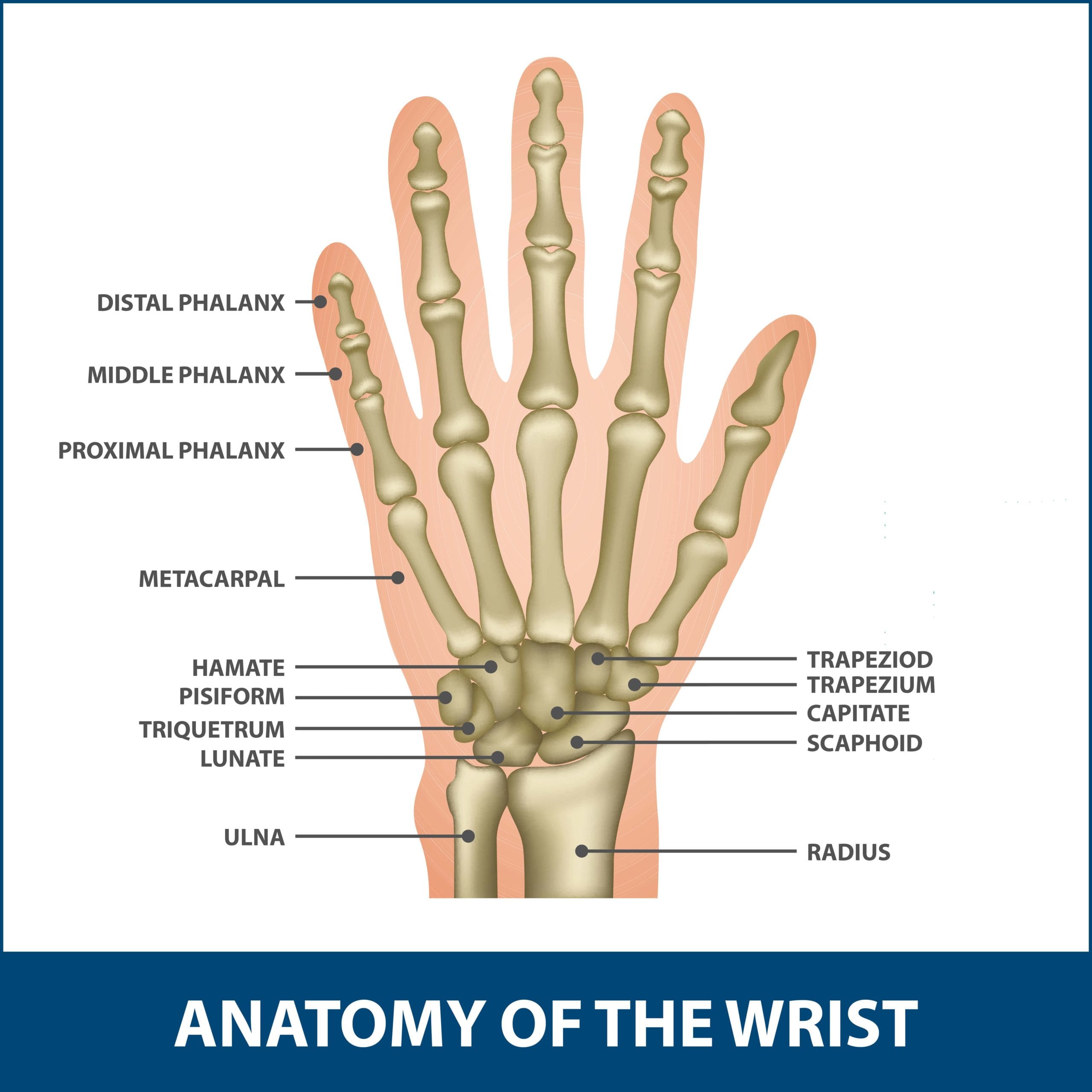 colles fracture splint