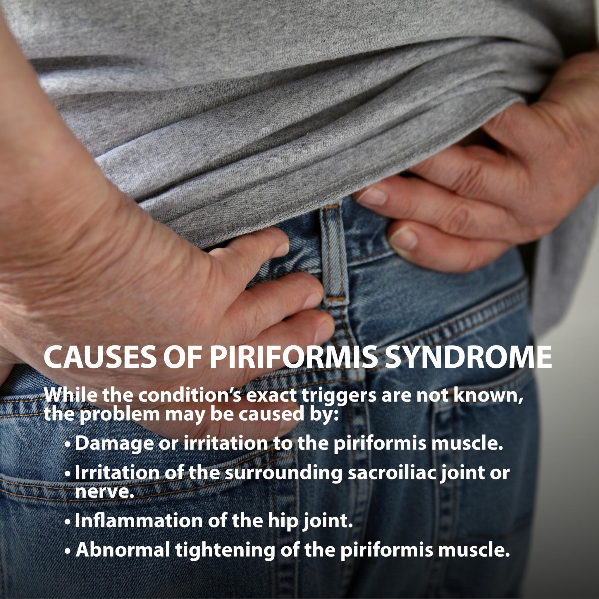 Piriformis Syndrome Florida Orthopaedic Institute