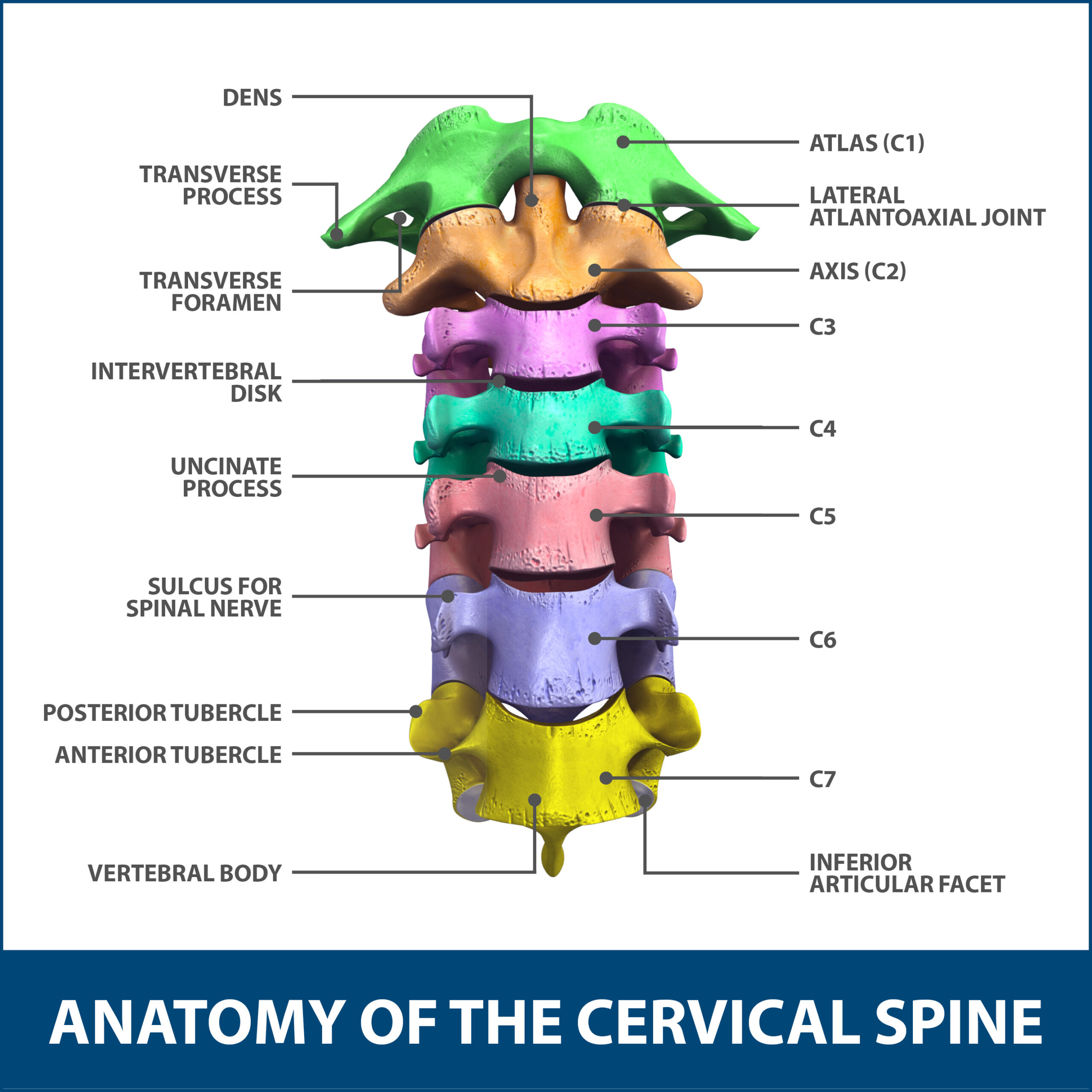 Anterior Cervical Corpectomy And Discectomy Florida Orthopaedic Institute