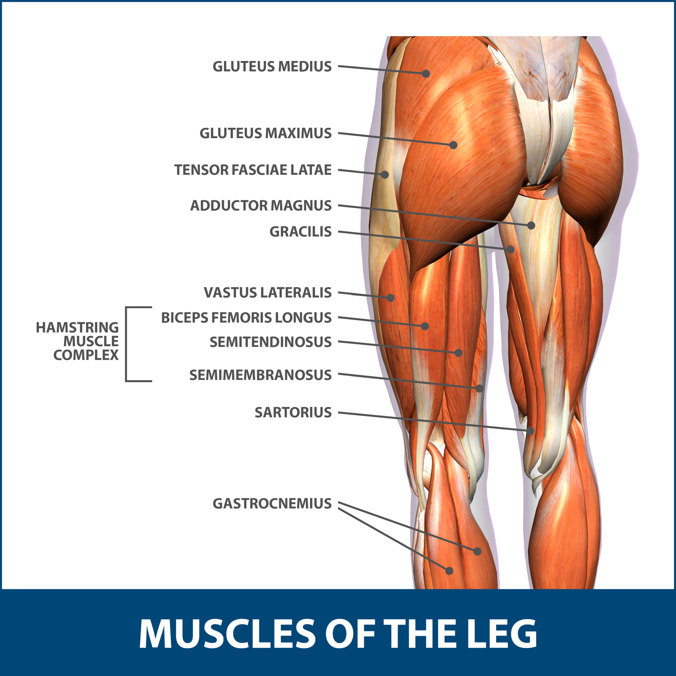 Muscle Strains of The Calf  Florida Orthopaedic Institute