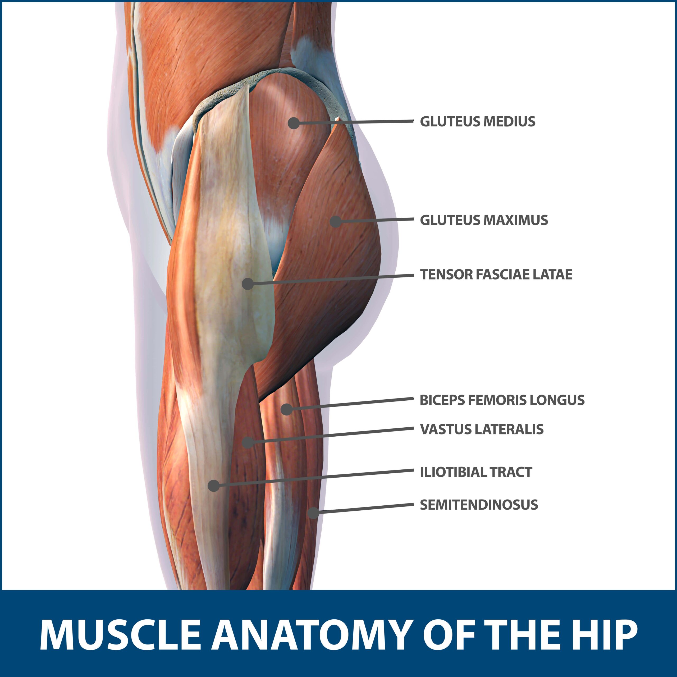 Normal anatomy of the lateral hip region. The gluteus medius