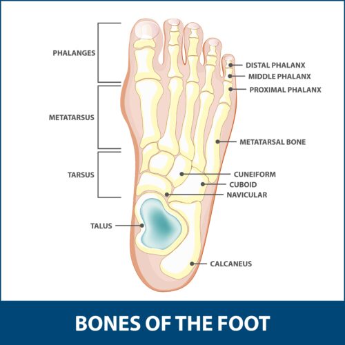Sports Injuries - Foot Fractures | Florida Orthopaedic Institute
