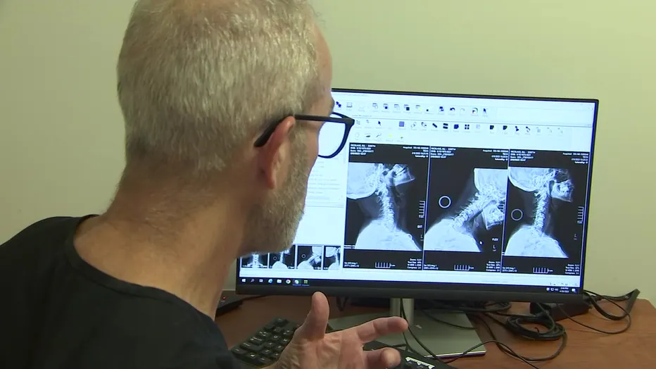 Dr. Small explaining neck X-rays