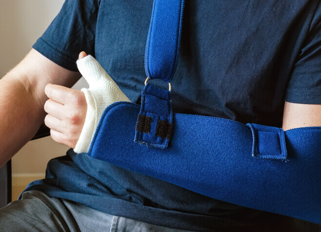 Man with broken wrist and arm in cast