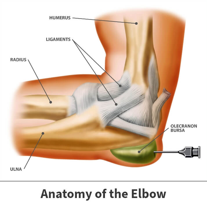 Anatomy of the elbow showing elbow bursitis