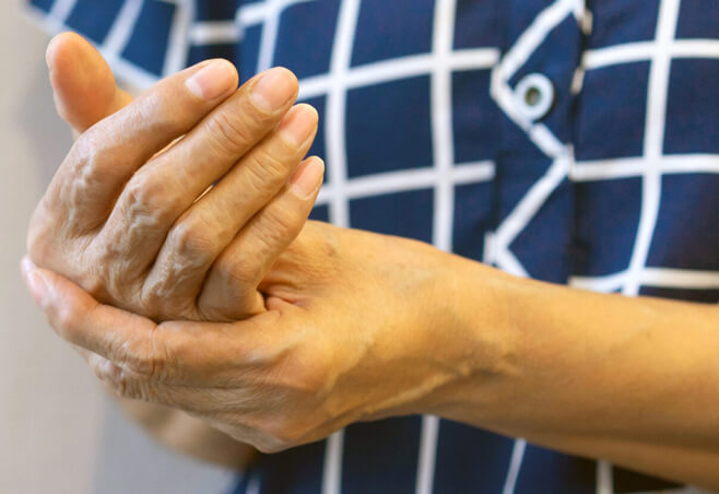 Woman with hand pain