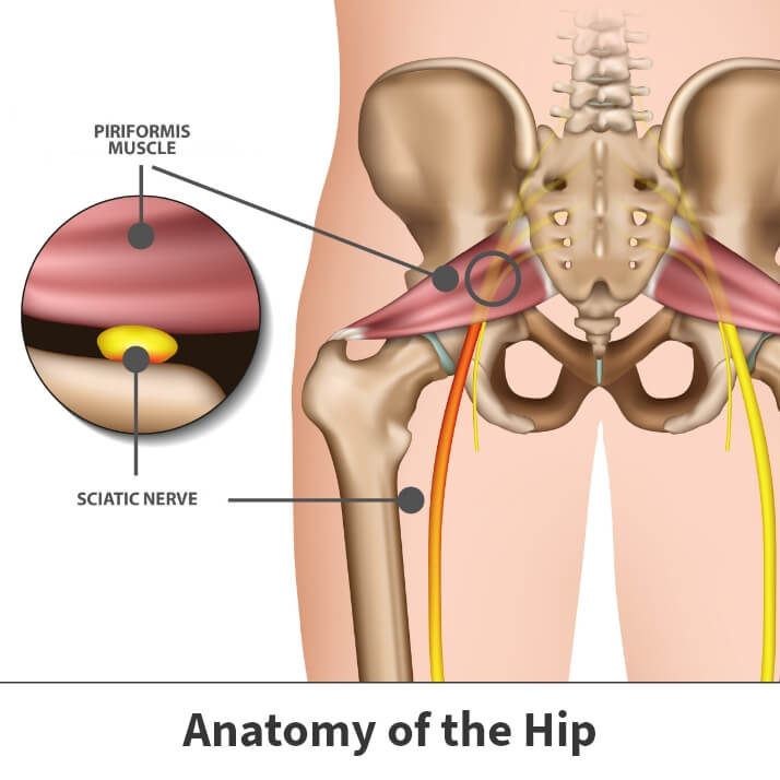 Anatomy of the hip showing piriformis syndrome