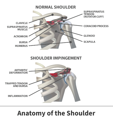 Anatomy of the shoulder, impingement