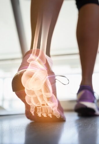 woman walking with indication of where foot and ankle bones are