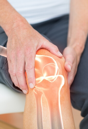 person holding knee with indication of where bones are