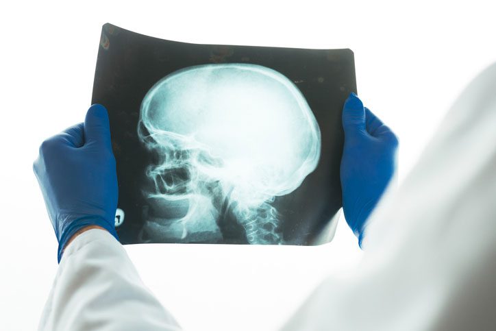 Doctor examining X-ray of the patient's skull