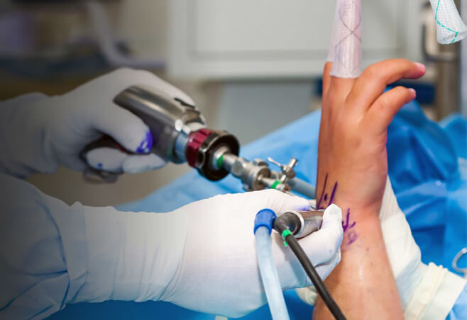 Patient during a wrist procedure